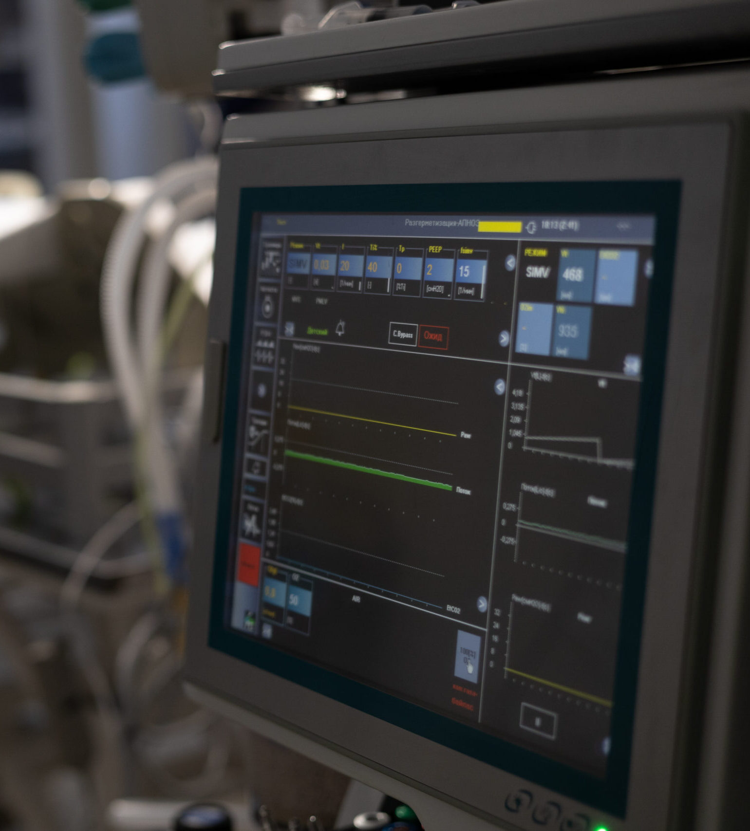 Primo piano di un monitor medico che mostra i segni vitali e le forme d'onda in un ambiente di chirurgia veterinaria, con apparecchiature mediche sfocate e un letto d'ospedale sullo sfondo.